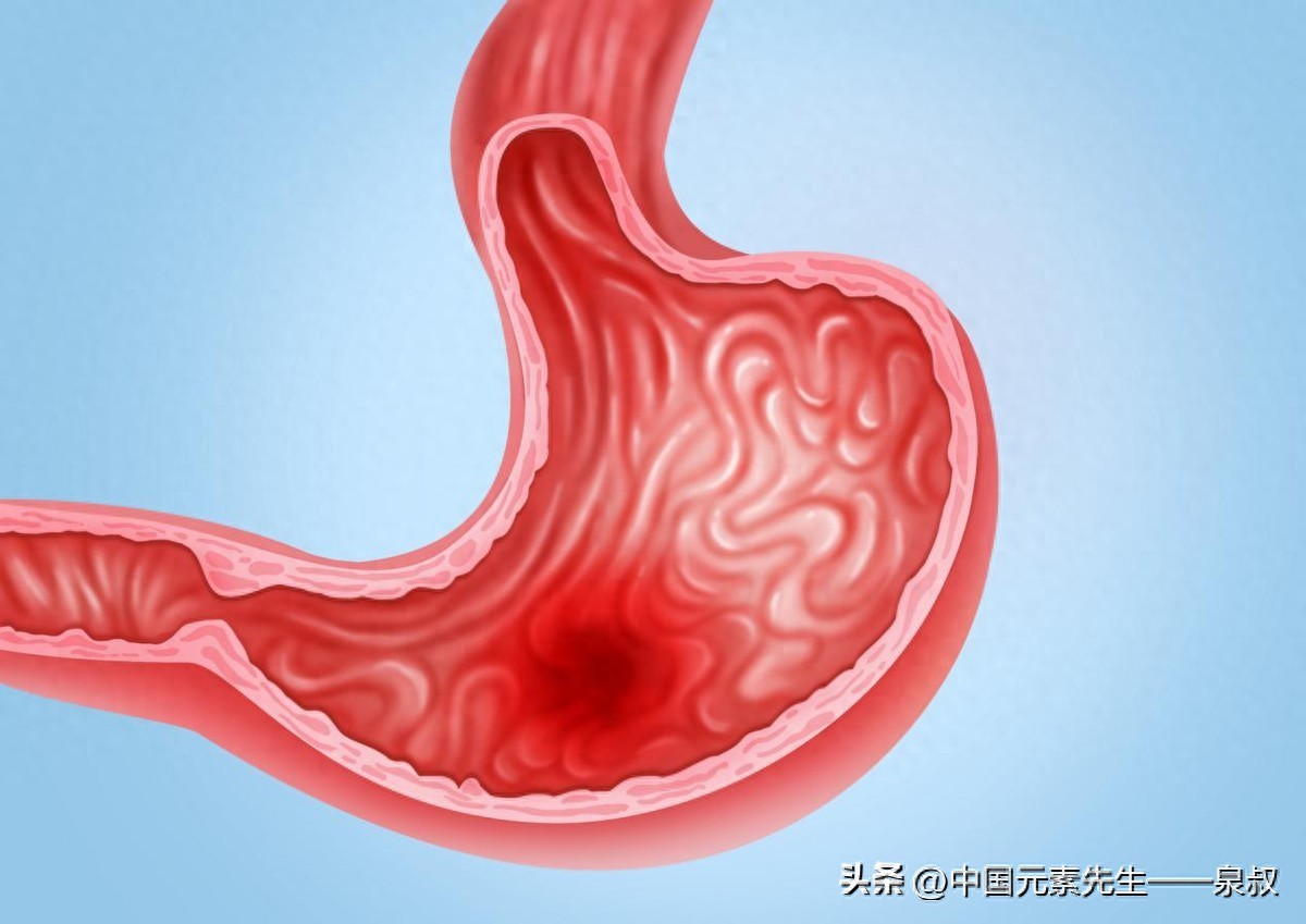 补硒改善胃病（中老年胃病硒元素）-硒宝网