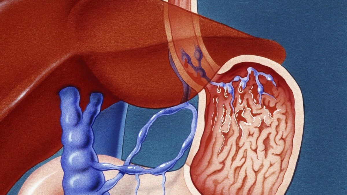 肝病补硒好吗(大蒜素与肝脏健康)-硒宝网