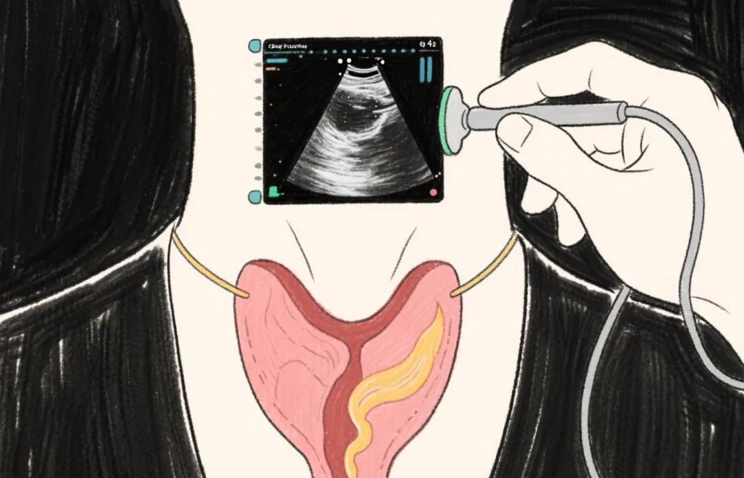 桥本补硒用量（甲状腺功能紊乱）-硒宝网