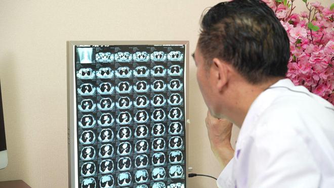 肺癌怎么补硒（肺癌治疗费用构成）-硒宝网