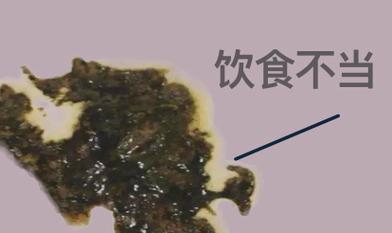 补硒大便变黑(饮食因素导致大便黑)-硒宝网