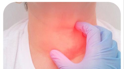 补硒水果之王（）-硒宝网