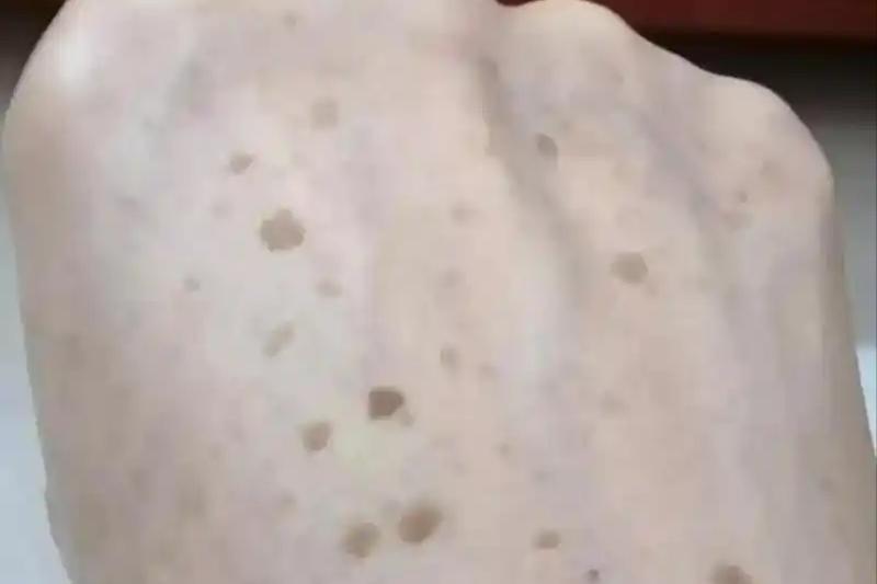 犊牛补铁补硒（硒缺乏症状与免疫力下降）-硒宝网