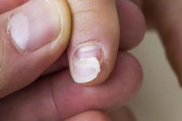 肺癌补硒吐血(硒与癌症关系)-硒宝网