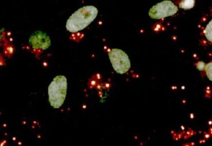 桥本补硒发胖（甲硫氨酸限制与健康寿命）-硒宝网