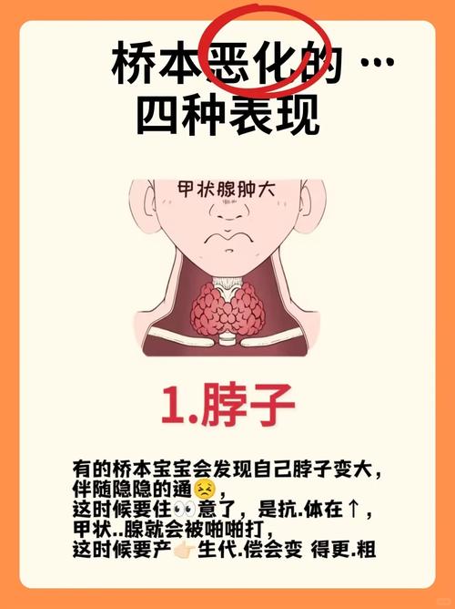 桥本补硒脱发(甲状腺功能减退症状)-硒宝网