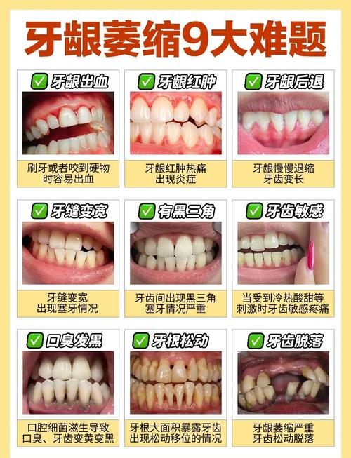 牙龈出血补硒（预防牙龈萎缩方法）-硒宝网