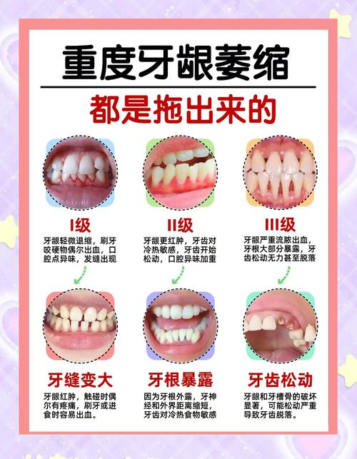 牙龈出血补硒（预防牙龈萎缩方法）-硒宝网