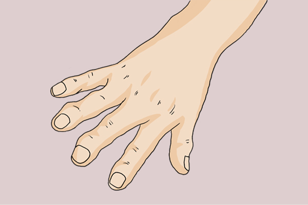 补硒治疗骨?。?远程机器人关节置换 ）-硒宝网