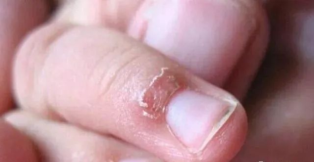 不能补硒人群（宝宝缺锌危害及症状）-硒宝网