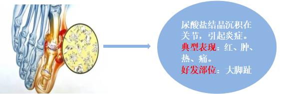 补硒防治痛风(高尿酸血症预防措施)-硒宝网