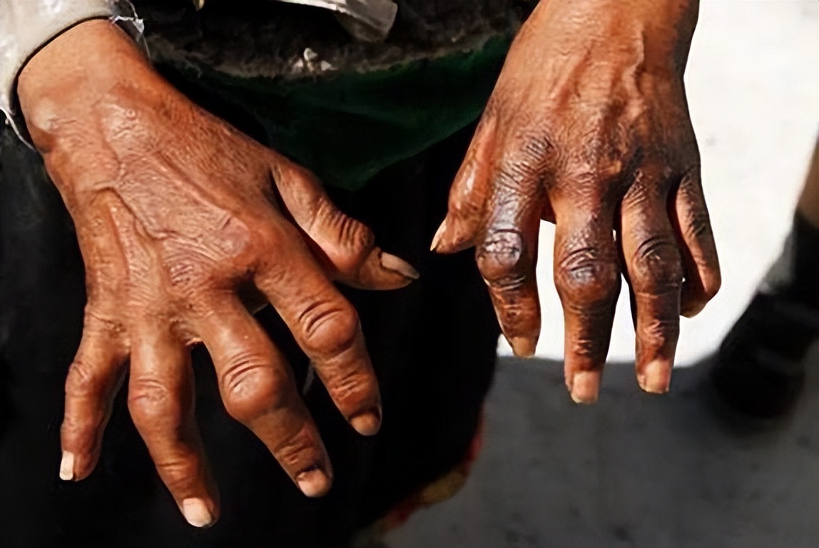 植物补硒产品(硒元素)-硒宝网