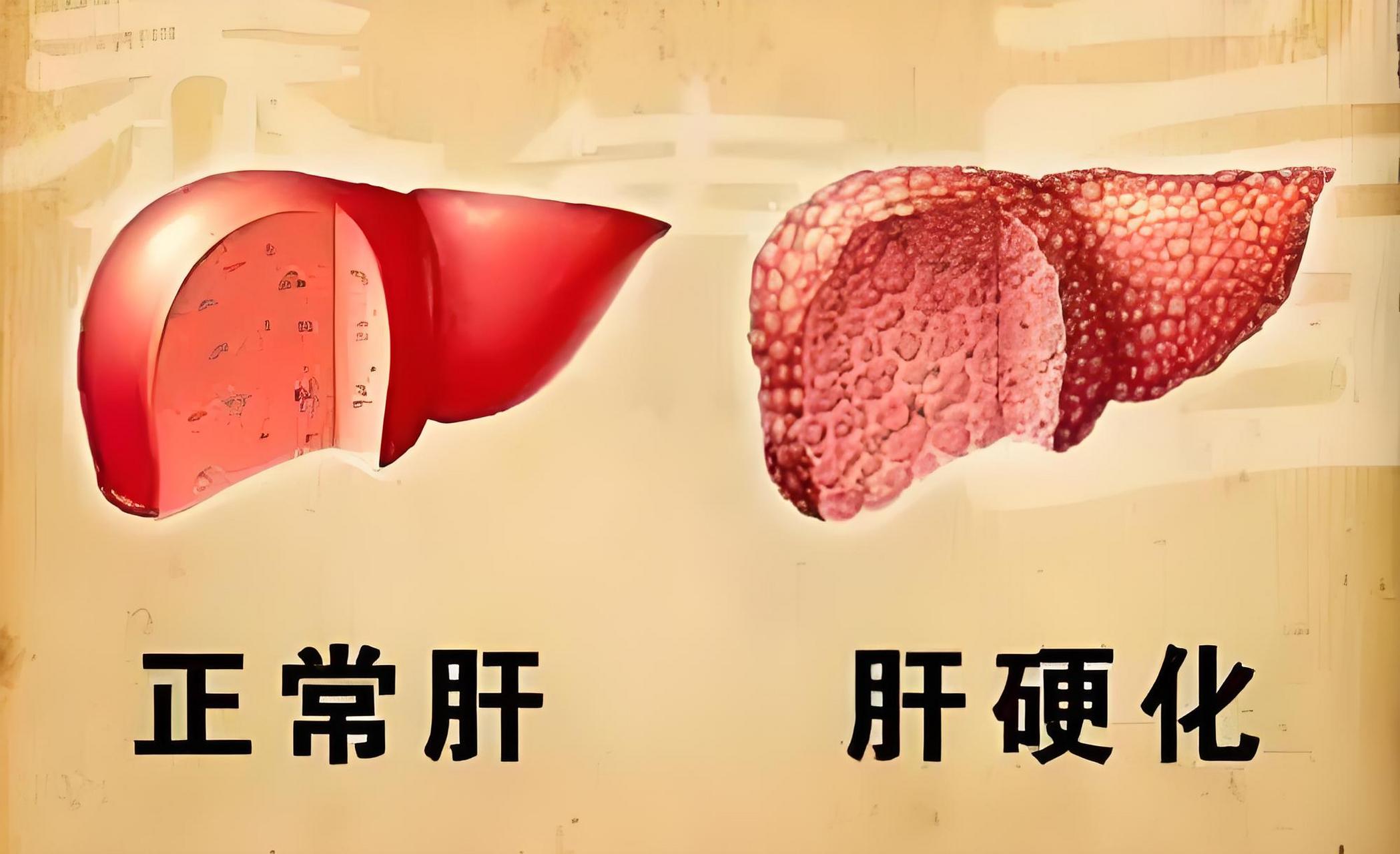 喝水怎样补硒(硒与肝硬化关系)-硒宝网