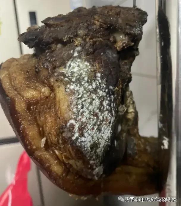 桥本黄芪补硒（桥本甲状腺炎饮食禁忌）-硒宝网