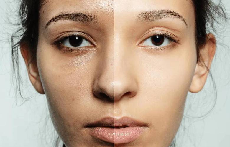 受到辐射补硒（延缓衰老饮食）-硒宝网