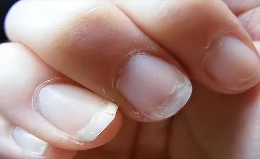 怎样有效补硒(硒与抗癌作用)-硒宝网