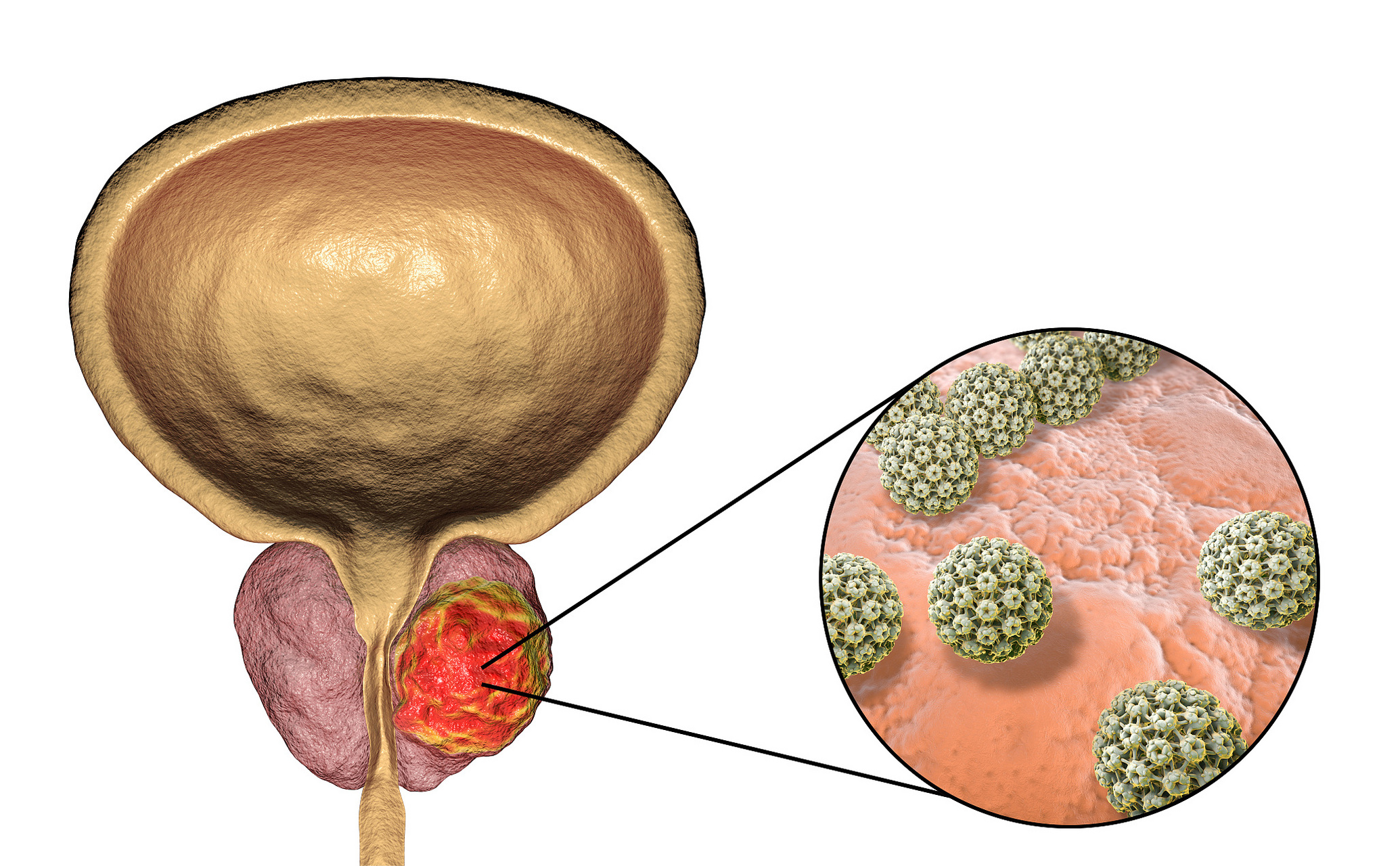 购买补硒产品(硒缺乏症状)-硒宝网