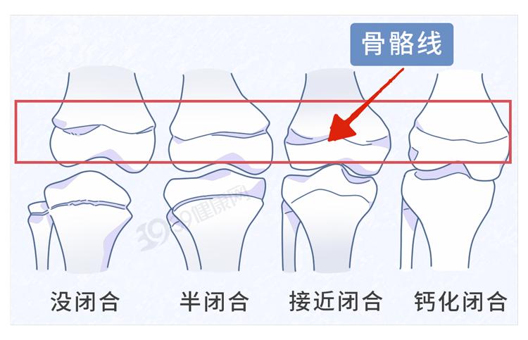补硒能致癌吗（血硒检测医生指导）-硒宝网