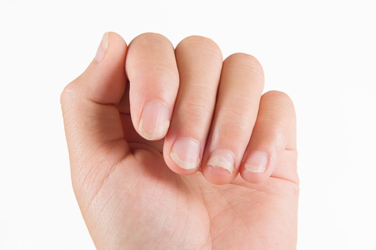 硒什么怎么补（硒与免疫系统功能）-硒宝网