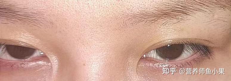 眼睛补硒价格（叶黄素酯与叶黄素区别）-硒宝网