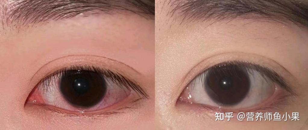 眼睛补硒价格（叶黄素酯与叶黄素区别）-硒宝网