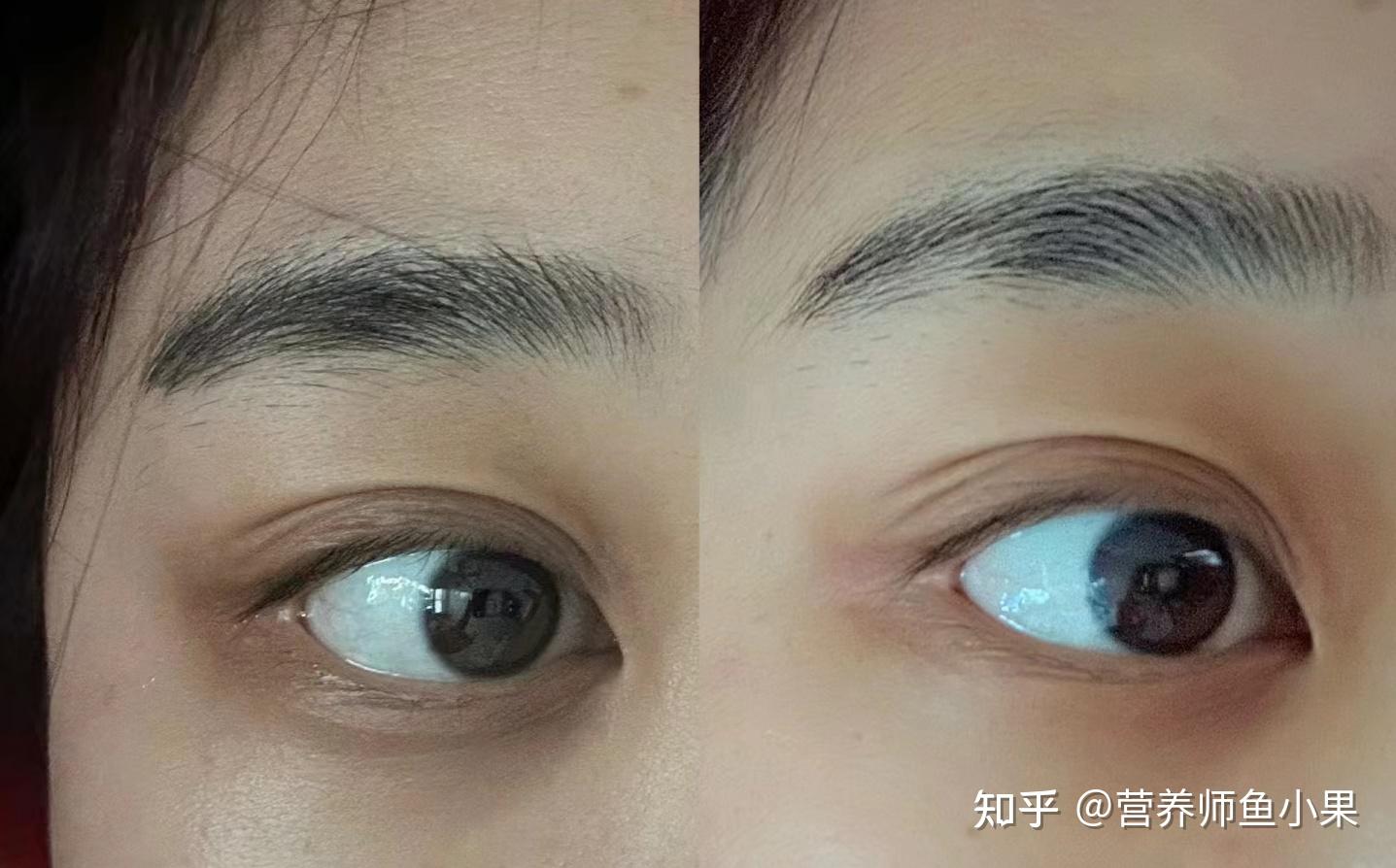 眼睛补硒价格（叶黄素酯与叶黄素区别）-硒宝网