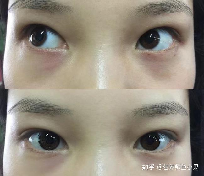 眼睛补硒价格（叶黄素酯与叶黄素区别）-硒宝网