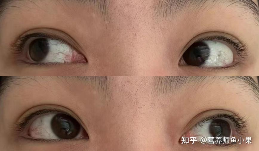 眼睛补硒价格（叶黄素酯与叶黄素区别）-硒宝网