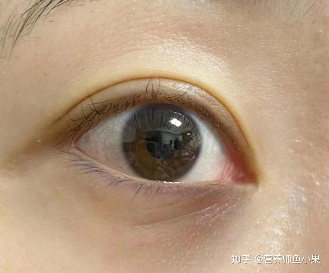 眼睛补硒价格（叶黄素酯与叶黄素区别）-硒宝网