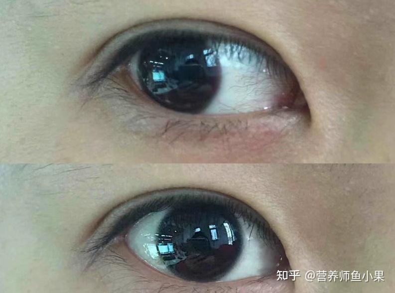 眼睛补硒价格（叶黄素酯与叶黄素区别）-硒宝网