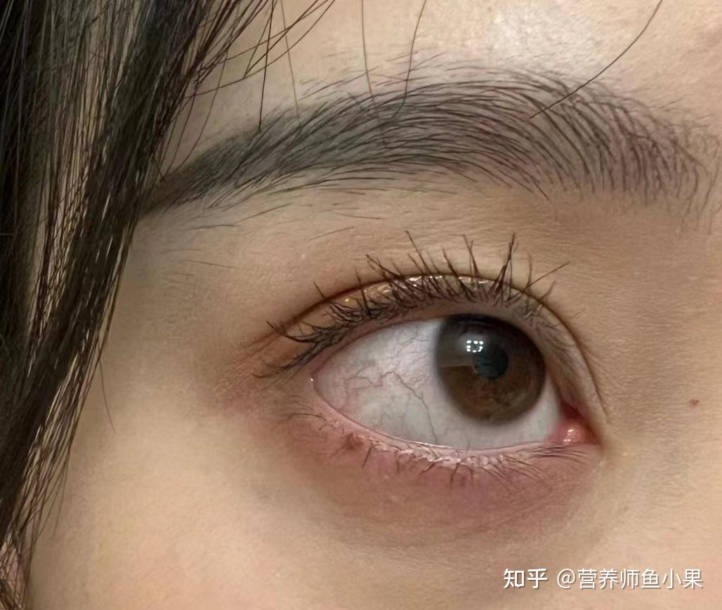 眼睛补硒价格（叶黄素酯与叶黄素区别）-硒宝网