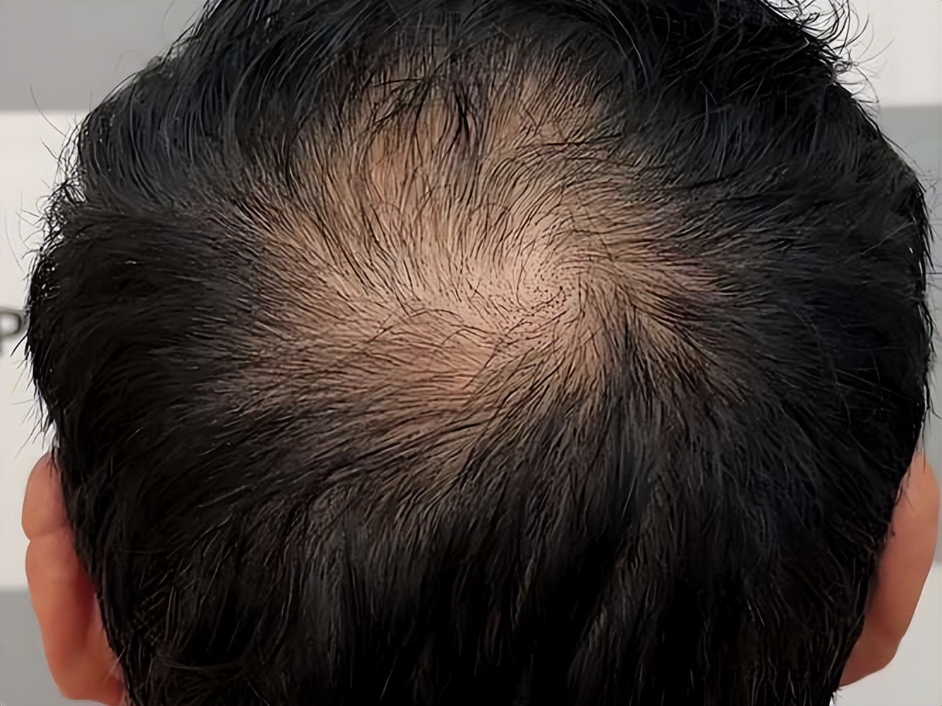 补硒类的药物（硒缺乏对健康的影响）-硒宝网