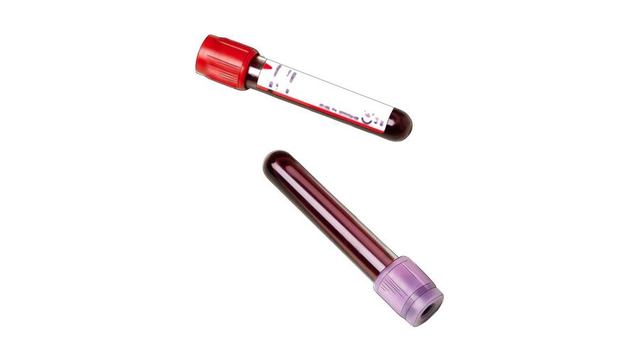 补硒类的药物（硒缺乏对健康的影响）-硒宝网