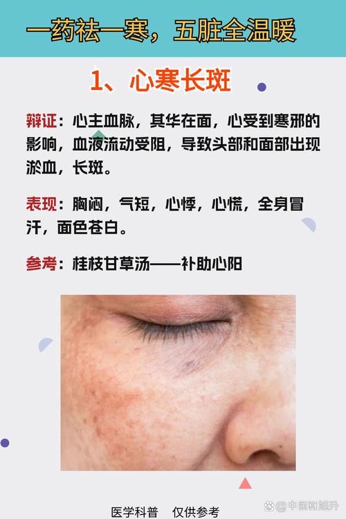 补硒导致长斑()-硒宝网