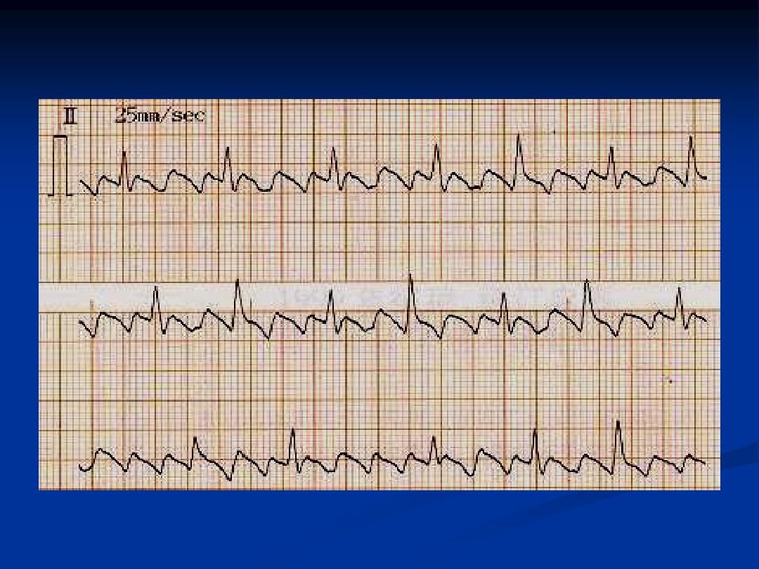 硒需每天补吗(硒缺乏对血管的影响)-硒宝网