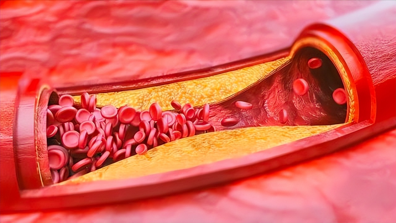 硒需每天补吗(硒缺乏对血管的影响)-硒宝网