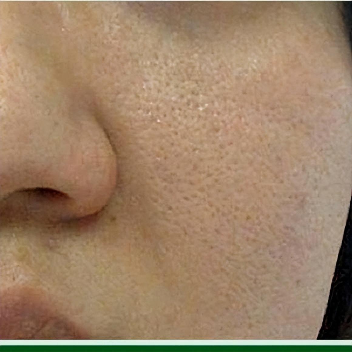 硒需每天补吗(硒缺乏对血管的影响)-硒宝网