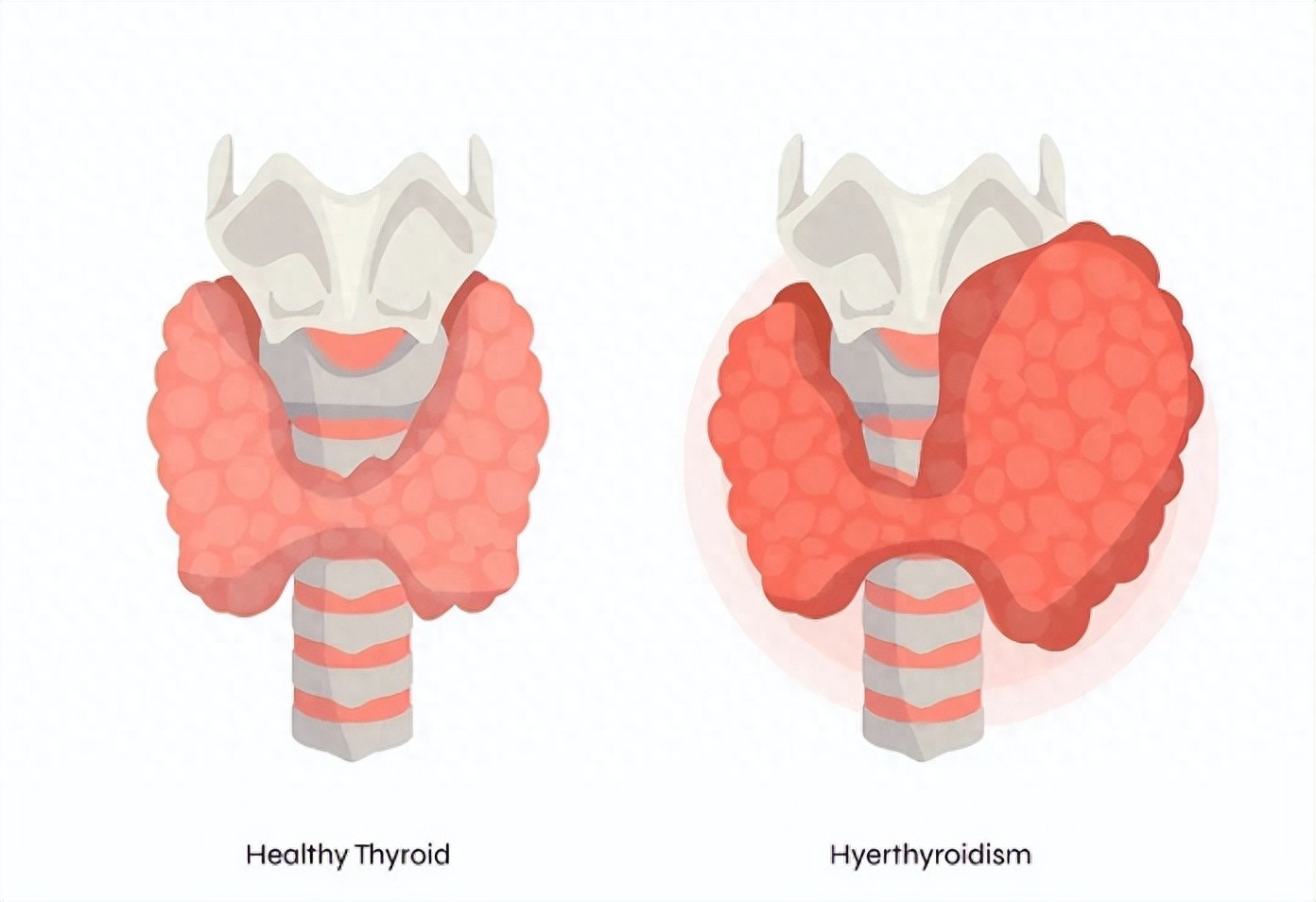硒酵母补肺吗(硒酵母片桥本甲状腺炎用量)-硒宝网