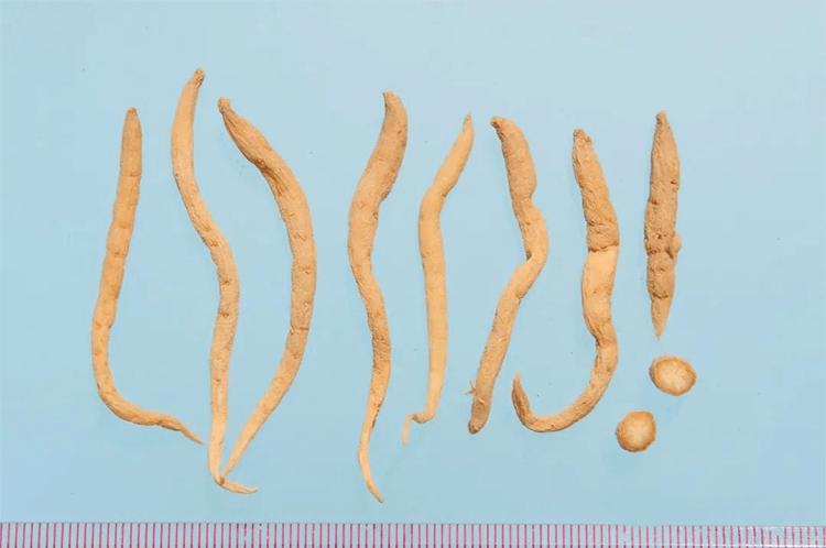 补硒参是什么（）-硒宝网