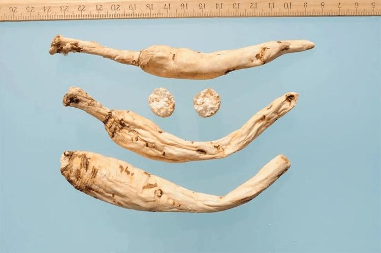 补硒参是什么（）-硒宝网