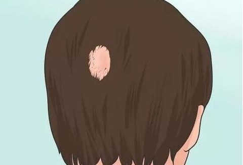 补硒会生发吗（）-硒宝网