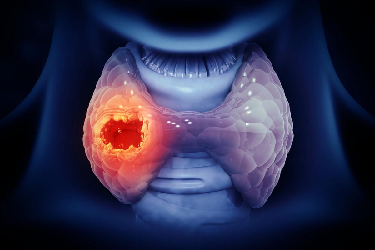 甜菜根补硒嘛（西兰花甲状腺保健）-硒宝网