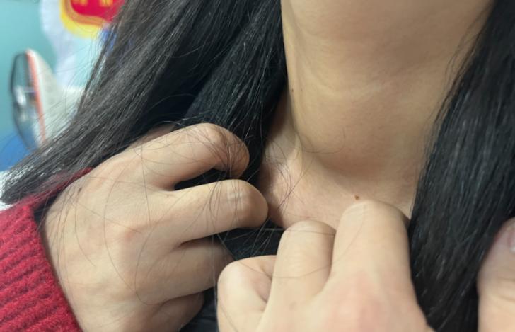 玉米能补硒吗(芥蓝护甲状腺蔬菜)-硒宝网