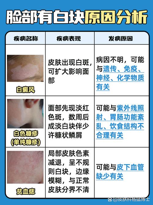 补硒 皮肤?。ㄎ氚遵胺纾?硒宝网