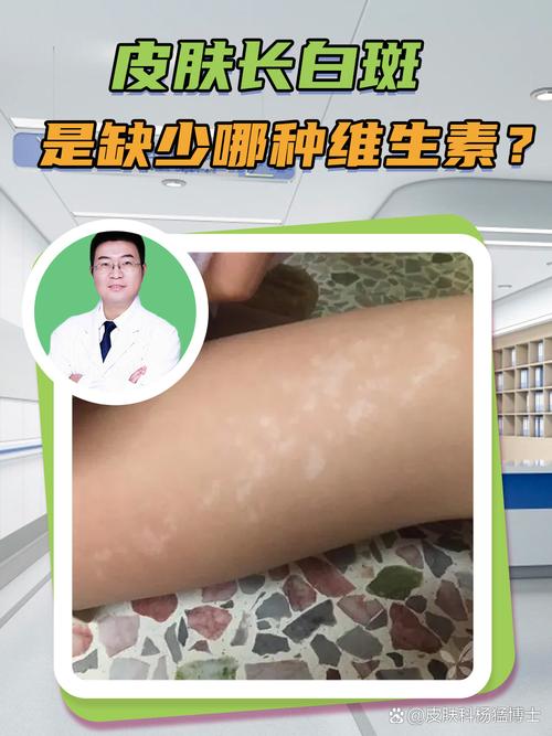 补硒 皮肤?。ㄎ氚遵胺纾?硒宝网