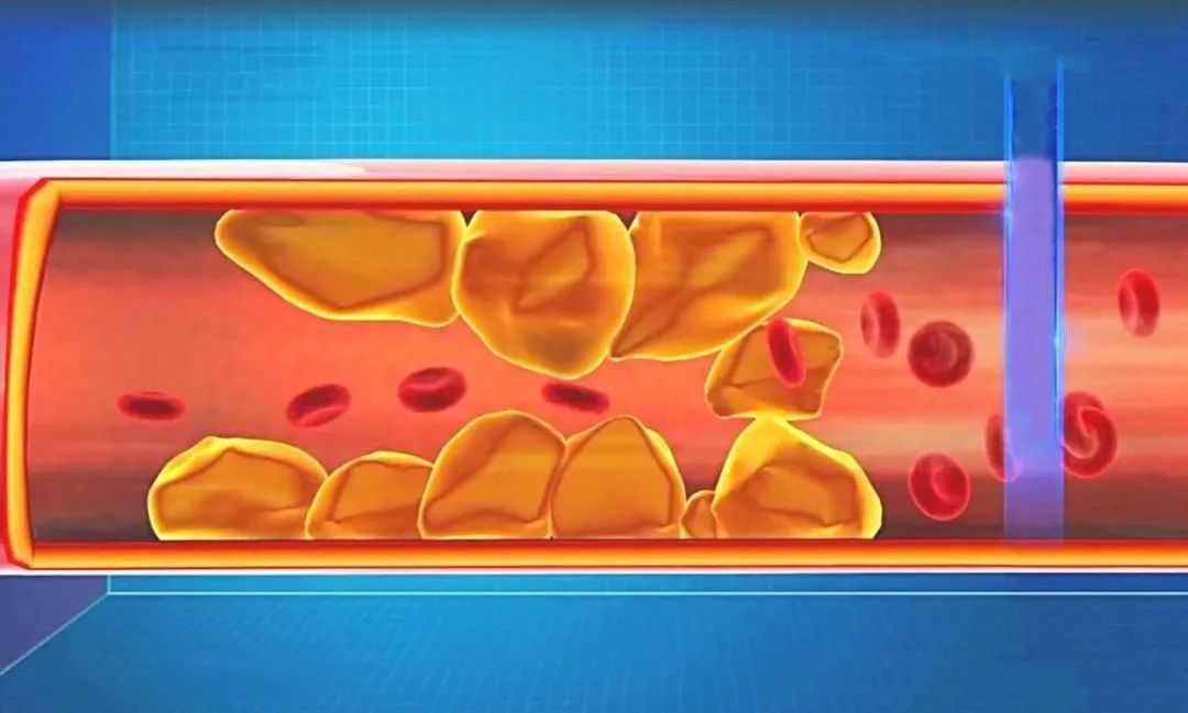 甲亢补硒的药（甲亢甲减症状区别）-硒宝网