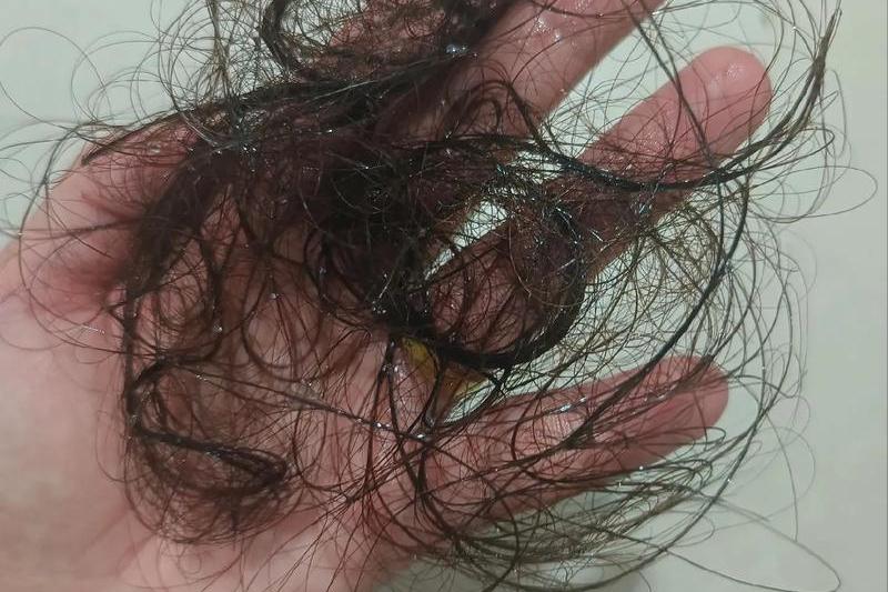 化疗后要补硒(硒摄入不足)-硒宝网