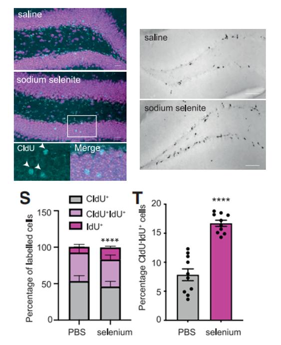 小脑萎缩补硒（硒元素与神经前体细胞增殖）-硒宝网